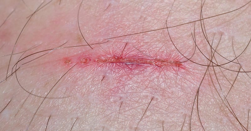 Trail écoresponsable en altitude : 7 gestes pour prévenir les blessures