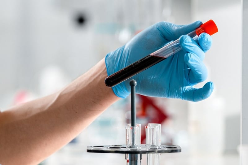 Les microplastiques inquiètent la fertilité masculine : ce que révèlent les études